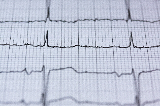 Hartritmevariabiliteit en veerkracht